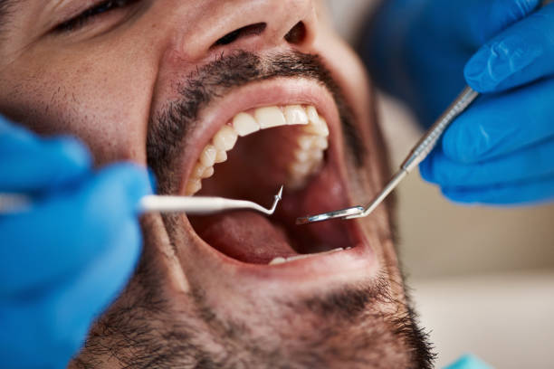 TMJ/TMD Treatment in Struthers, OH